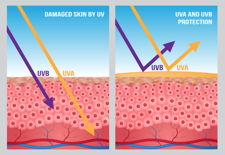 4 Ways UV Light Affects Your Vision Sugiki Portis Yim