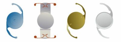 four different intraocular lenses used in cataract surgery